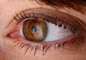 close up of eyeball, cataract treatment western MA, cataracts springfield MA, cataract surgeon Springfield MA